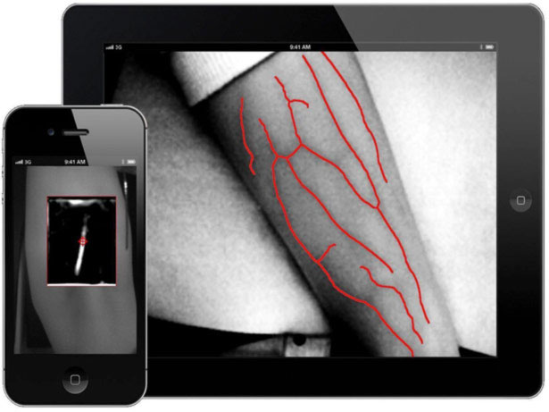 VascuLogic VenousMobile